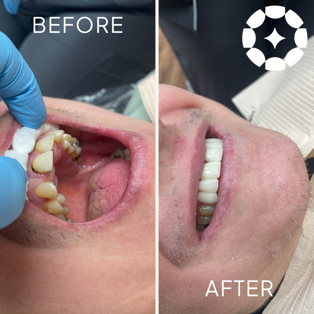 From dull to dazzling! Witness the power of expert dental care by Dr. Hollie Paschke in Venice, Florida!